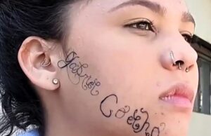 ‘Me sinto livre’, diz jovem ao iniciar remoção de tatuagem feita no rosto pelo ex-namorado