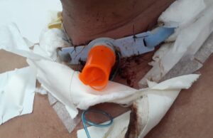 Grande corrida em favor do Motoboy que teve o pescoço cortado por linha chilena acontece neste domingo (21), em São Luís, participe